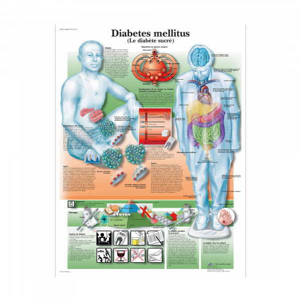 Planche anatomique - Le diabète - Anatomie et pathologie
