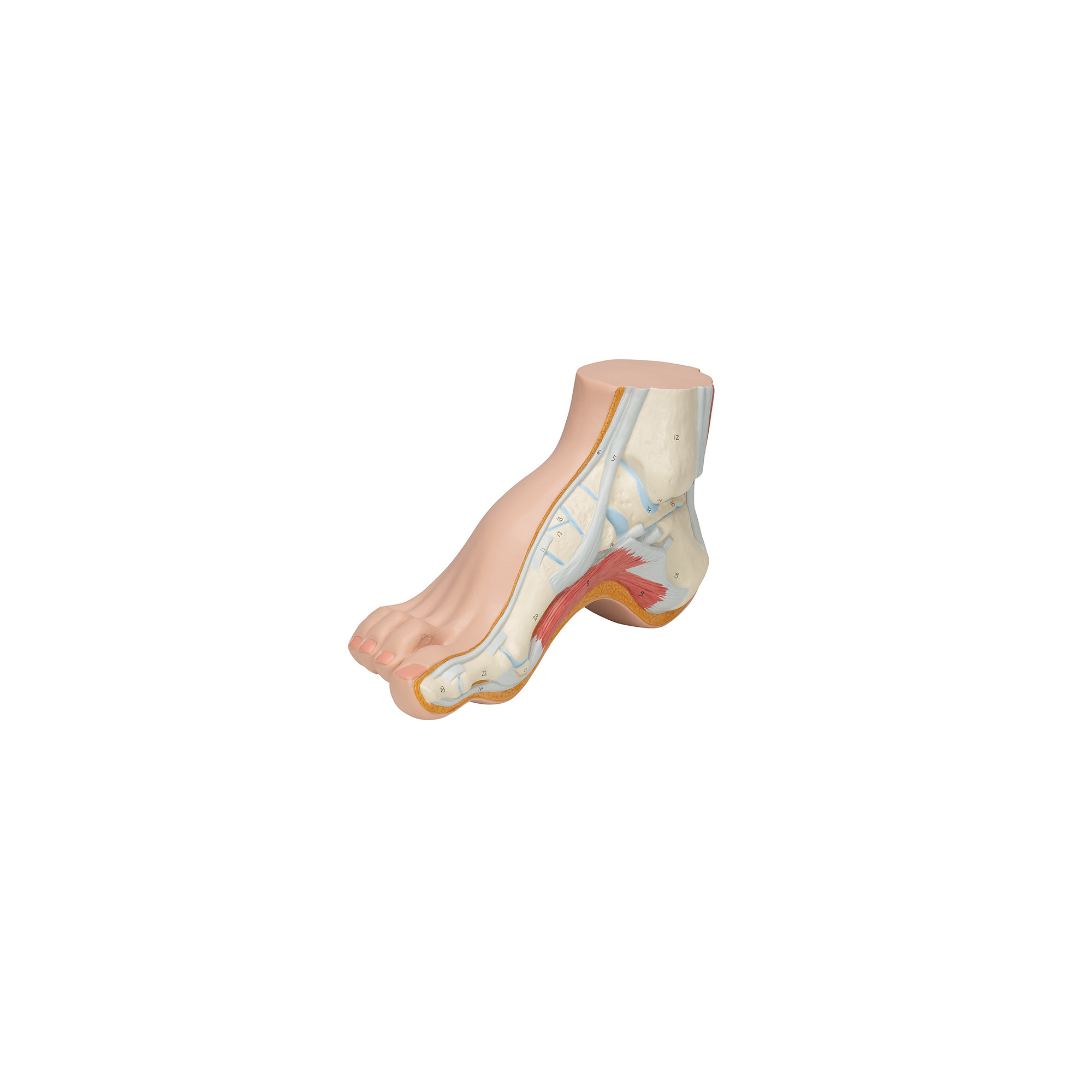 Squelette d'un pied creux (Pes Cavus)