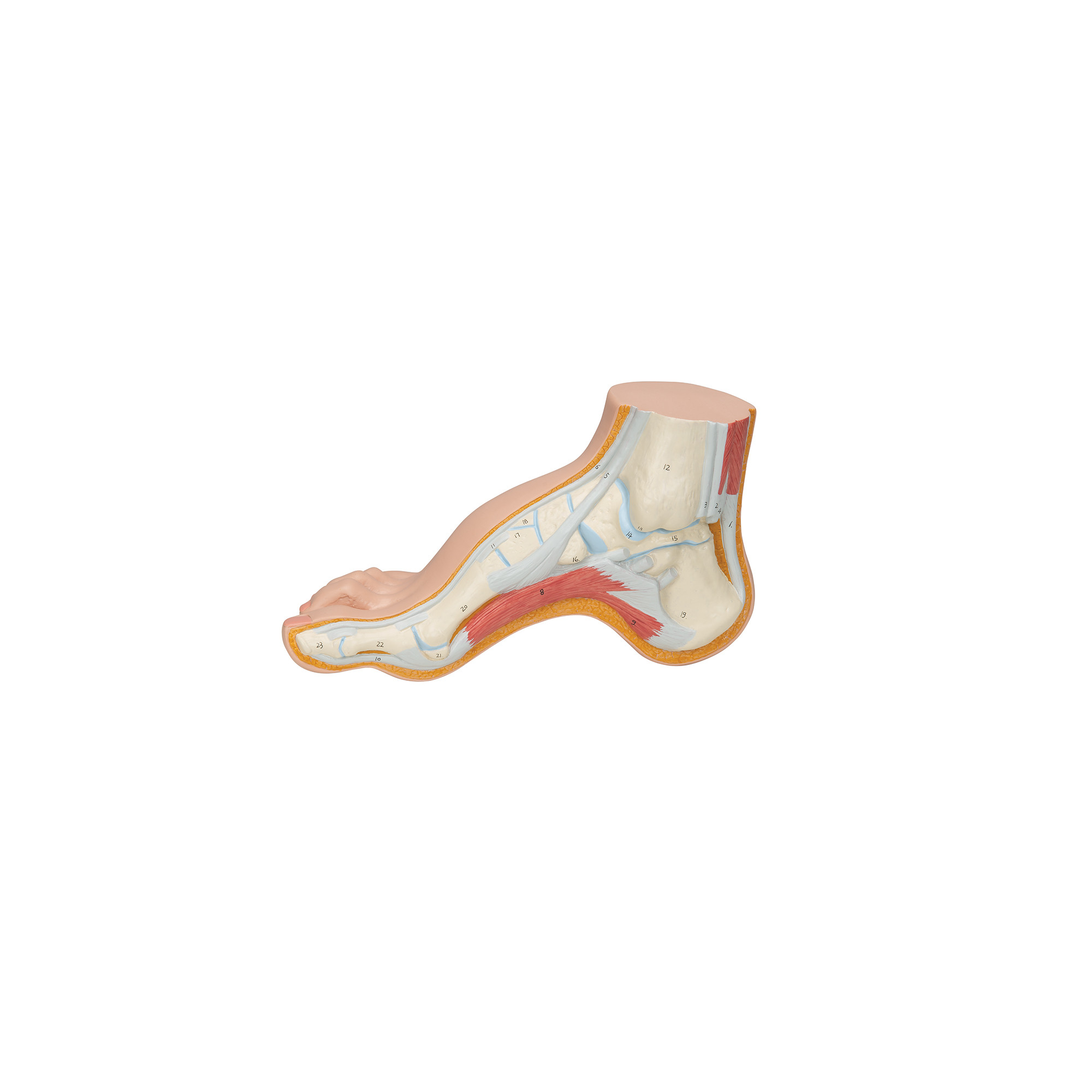 Squelette d'un pied creux (Pes Cavus)